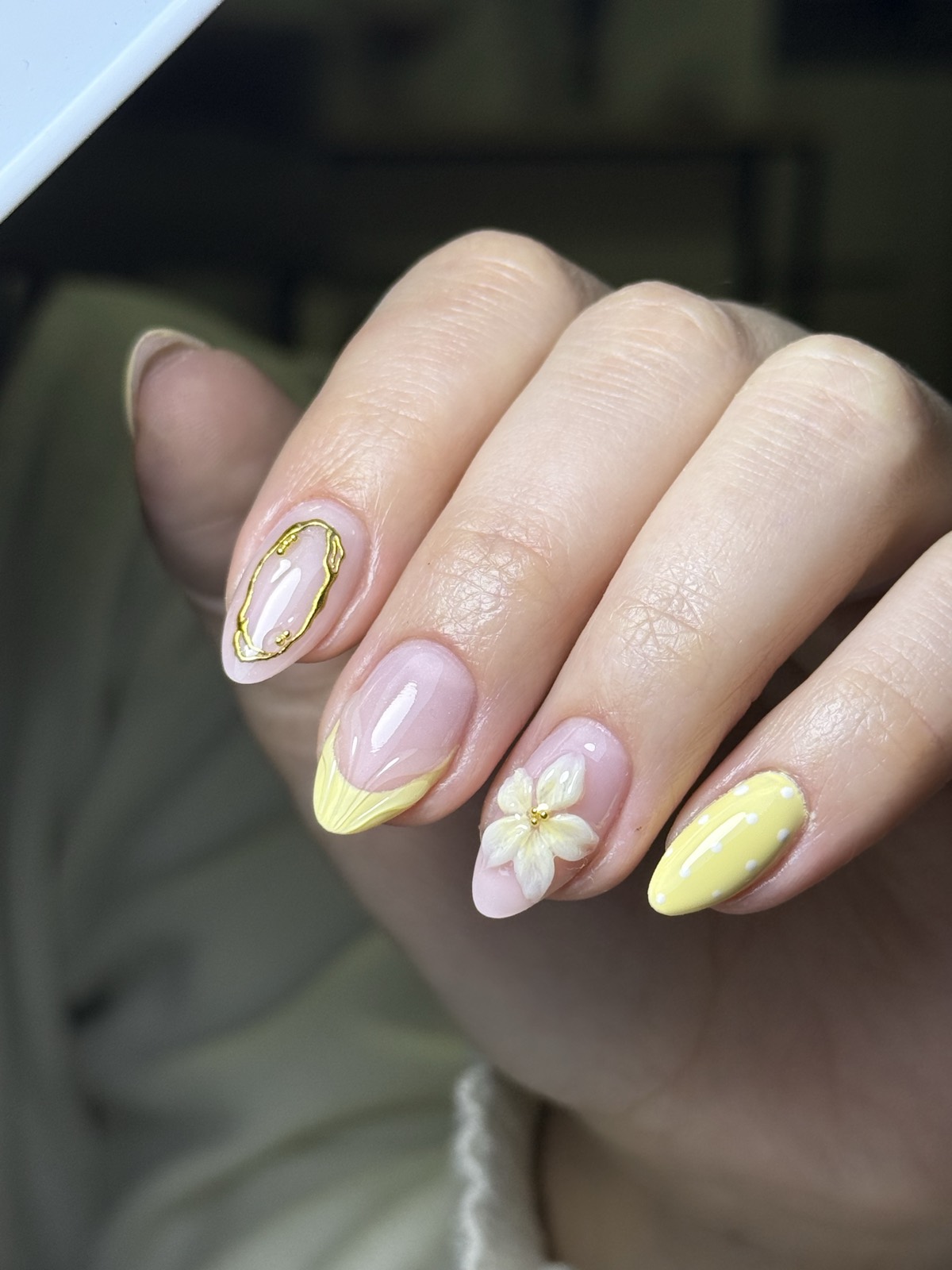 Kapping con full deco