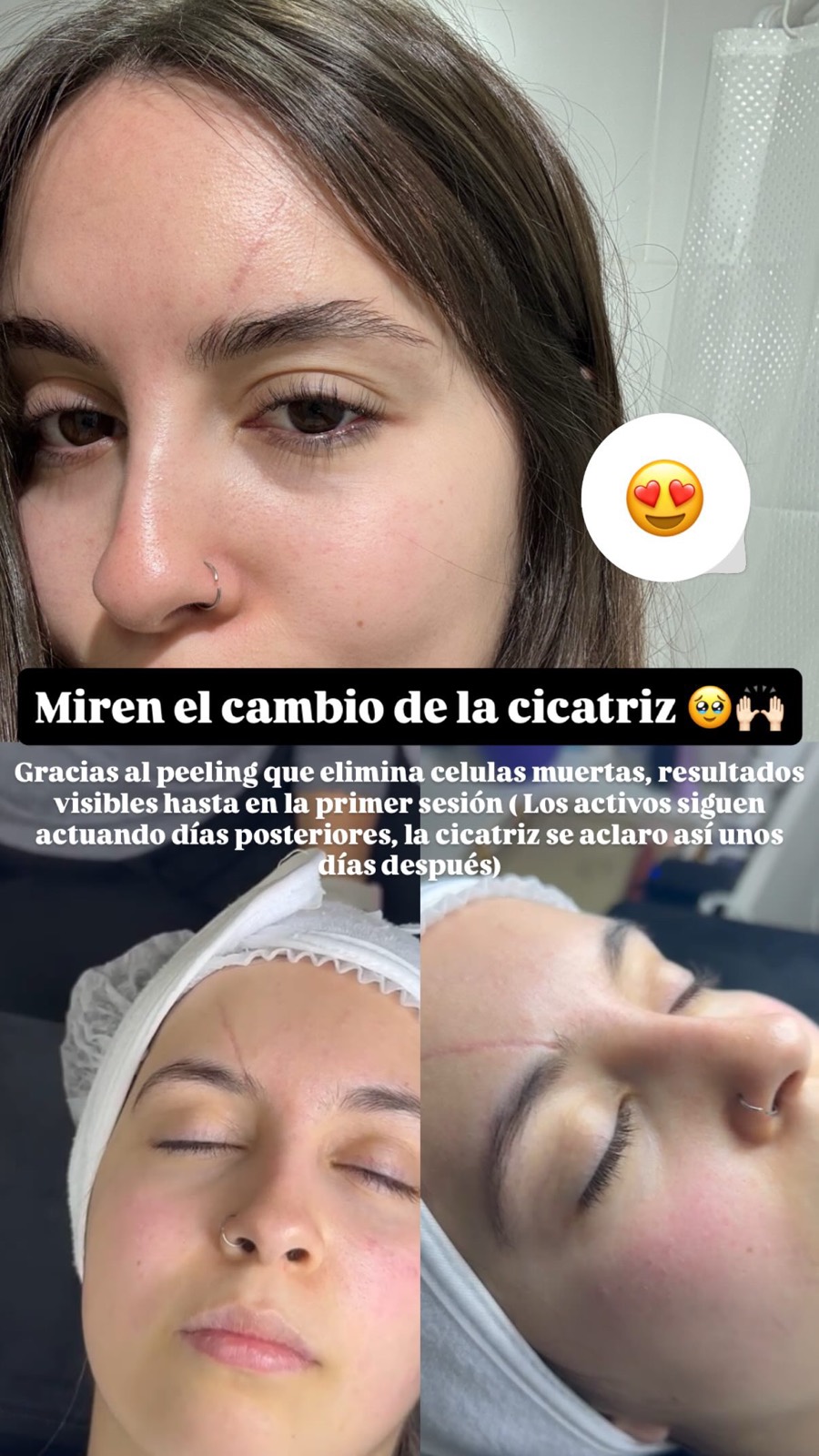 Trabajo del centro