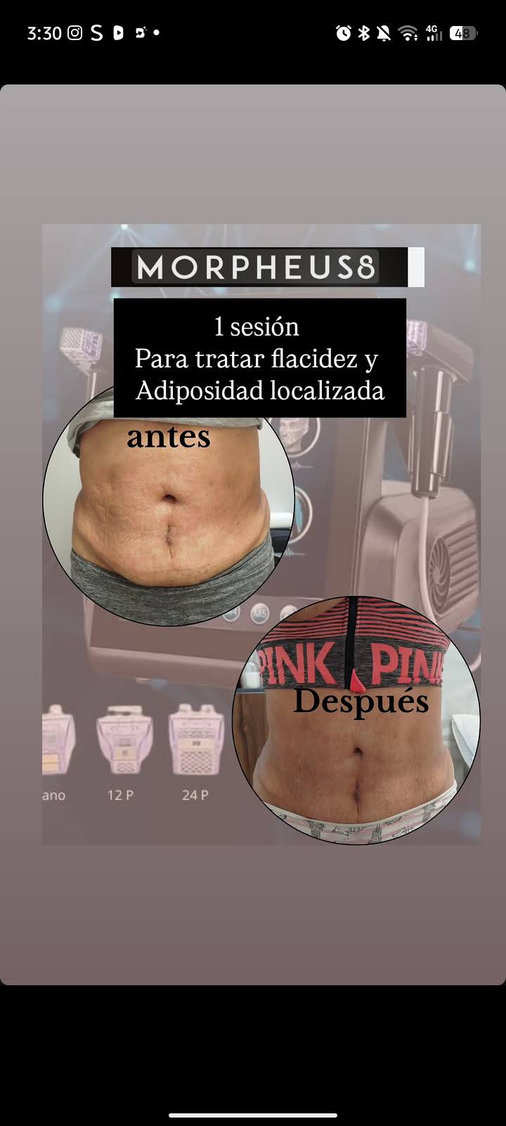 Trabajo del centro