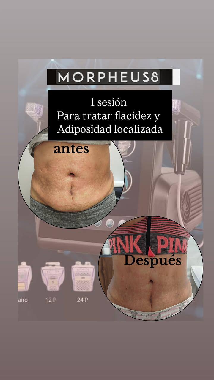 Trabajo del centro