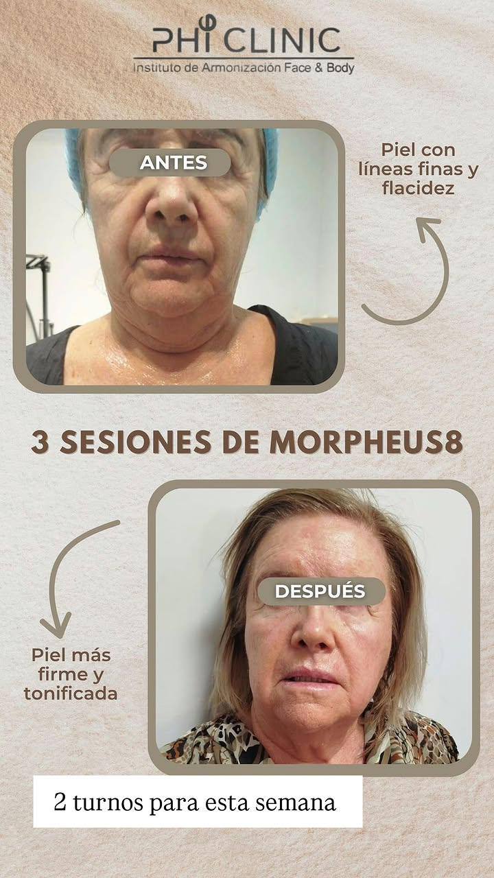 Trabajo del centro