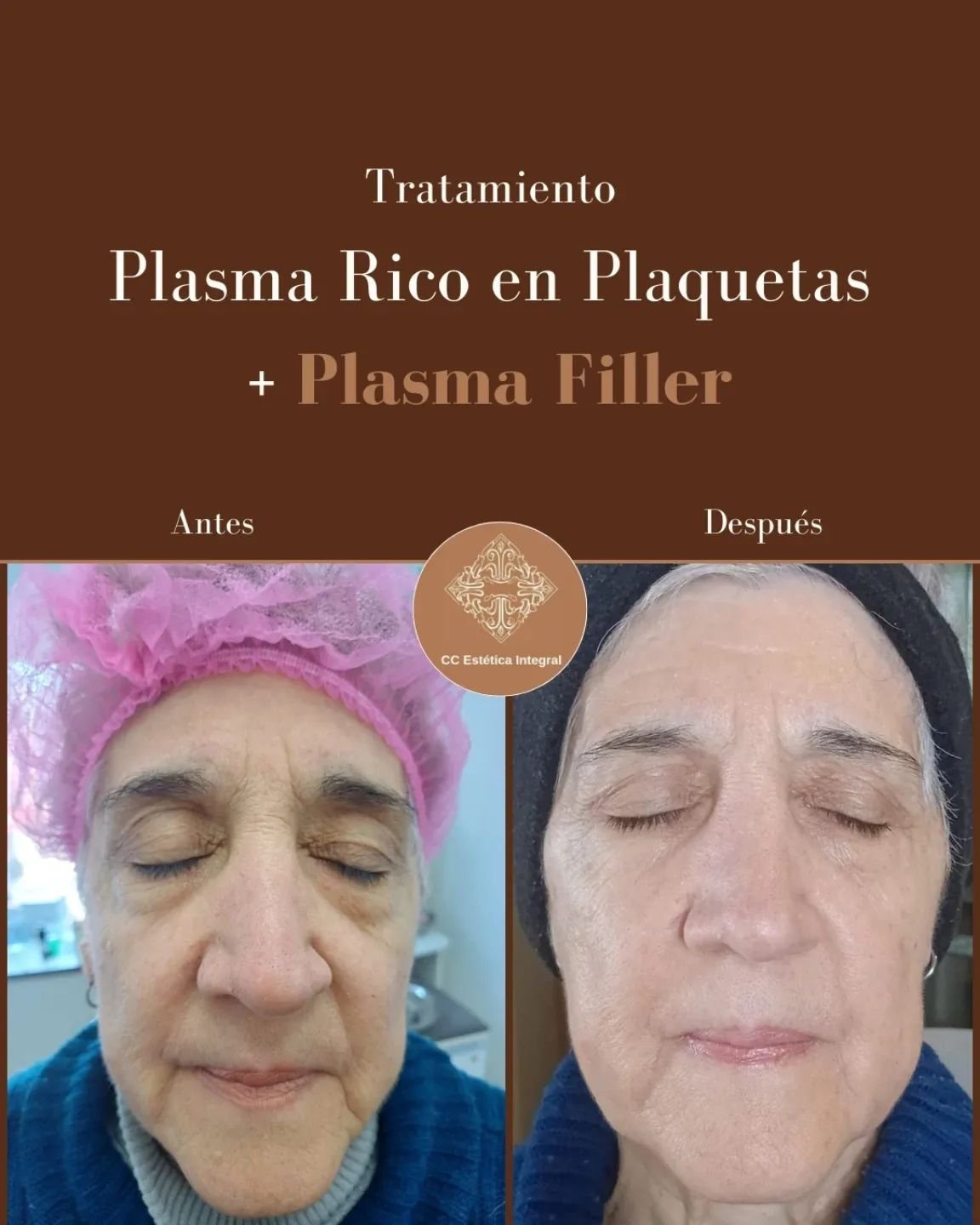 Trabajo del centro